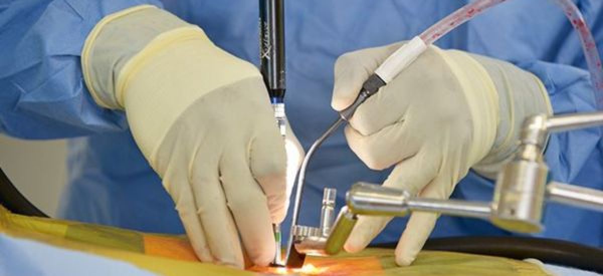 Minimally invasive spine surgery