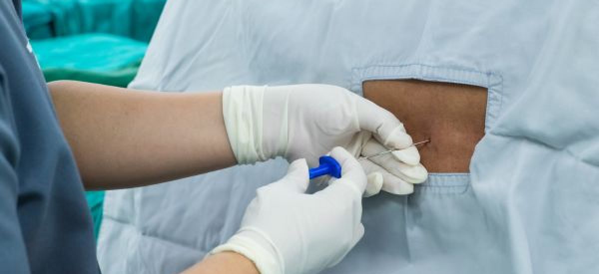 Spinal Injections